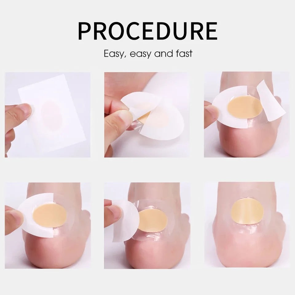 Protectores o parches de gel para TALON