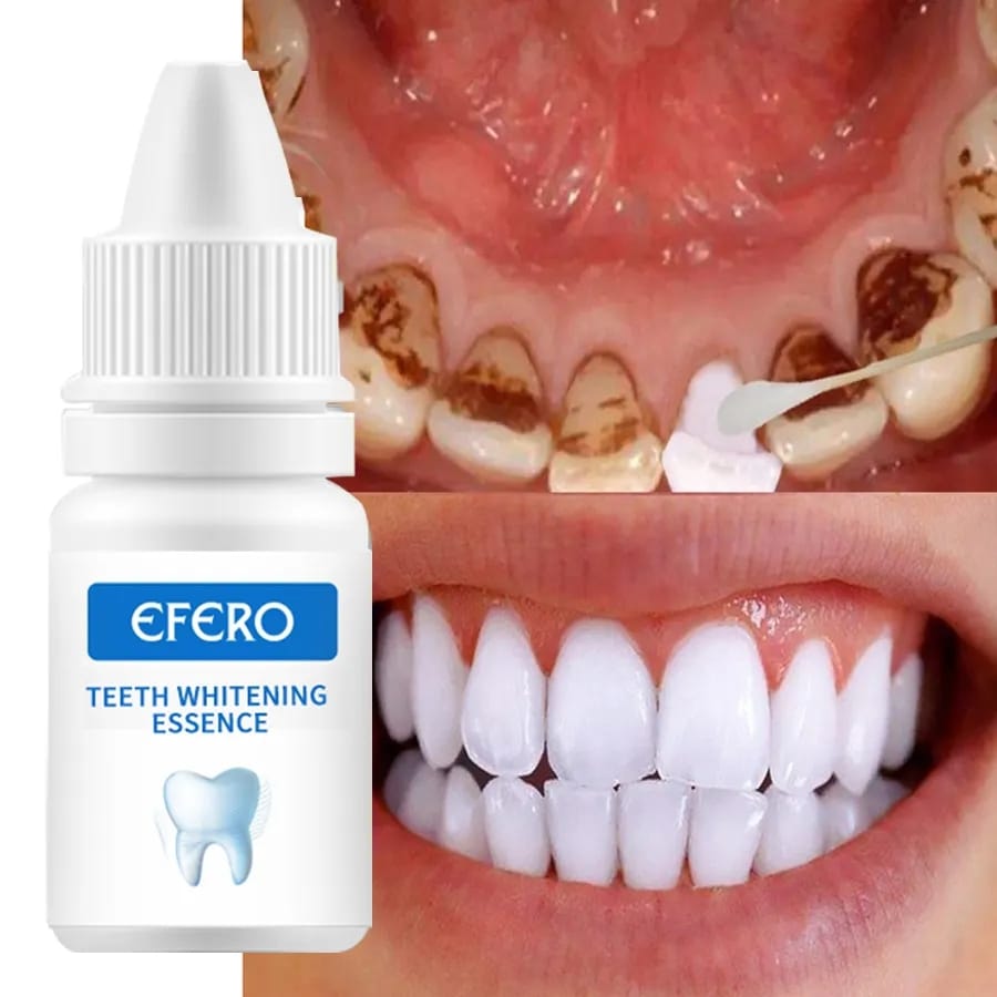 Blanqueamiento dental