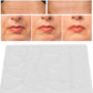 Parches Antiarrugas facial