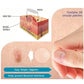 Parche removedor de acne (24 unidades)